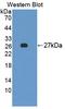 C-Terminal Src Kinase antibody, LS-C374446, Lifespan Biosciences, Western Blot image 