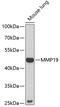 Matrix Metallopeptidase 19 antibody, 22-383, ProSci, Western Blot image 
