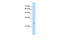 Immediate Early Response 2 antibody, 28-081, ProSci, Western Blot image 