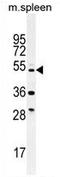 Tetratricopeptide Repeat Domain 23 Like antibody, AP54395PU-N, Origene, Western Blot image 