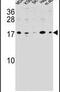 S100 Calcium Binding Protein Z antibody, PA5-24124, Invitrogen Antibodies, Western Blot image 