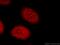 Tudor Domain Containing 3 antibody, 13359-1-AP, Proteintech Group, Immunofluorescence image 