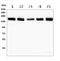 SWI/SNF-Related, Matrix-Associated Actin-Dependent Regulator Of Chromatin, Subfamily A, Containing DEAD/H Box 1 antibody, A06049-1, Boster Biological Technology, Western Blot image 