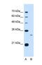 Complement C1q B Chain antibody, NBP1-59056, Novus Biologicals, Western Blot image 