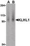 Kelch Like Family Member 1 antibody, PA5-19998, Invitrogen Antibodies, Western Blot image 