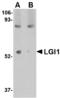 Leucine Rich Glioma Inactivated 1 antibody, LS-C53277, Lifespan Biosciences, Western Blot image 
