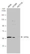 Patatin Like Phospholipase Domain Containing 2 antibody, GTX109941, GeneTex, Western Blot image 