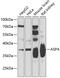 Aspartoacylase antibody, GTX55521, GeneTex, Western Blot image 