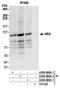Hepatocyte Growth Factor-Regulated Tyrosine Kinase Substrate antibody, A300-989A, Bethyl Labs, Immunoprecipitation image 