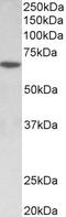 SRY-Box 11 antibody, STJ72703, St John