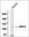 Wolframin ER Transmembrane Glycoprotein antibody, orb158723, Biorbyt, Western Blot image 