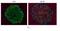 Aldehyde Dehydrogenase 1 Family Member A3 antibody, NBP2-15339, Novus Biologicals, Immunohistochemistry frozen image 