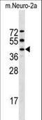 Serine/Threonine Kinase 32A antibody, LS-C158268, Lifespan Biosciences, Western Blot image 