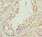 EF-Hand Domain Containing 1 antibody, LS-C675689, Lifespan Biosciences, Immunohistochemistry paraffin image 
