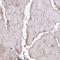 Charged Multivesicular Body Protein 1B antibody, HPA061997, Atlas Antibodies, Immunohistochemistry paraffin image 