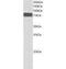 NUMB Endocytic Adaptor Protein antibody, PA1-31840, Invitrogen Antibodies, Western Blot image 