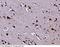 6-Pyruvoyltetrahydropterin Synthase antibody, 14332-T24, Sino Biological, Immunohistochemistry paraffin image 