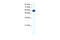 Solute Carrier Family 18 Member A1 antibody, 28-326, ProSci, Western Blot image 