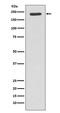 TSC Complex Subunit 2 antibody, M00229, Boster Biological Technology, Western Blot image 