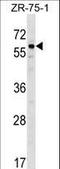 Bone Morphogenetic Protein 3 antibody, LS-C156834, Lifespan Biosciences, Western Blot image 