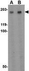 Adhesion G Protein-Coupled Receptor A2 antibody, GTX31327, GeneTex, Western Blot image 