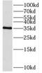 Short Chain Dehydrogenase/Reductase Family 39U Member 1 antibody, FNab07673, FineTest, Western Blot image 
