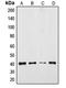 Transmembrane Protein Adipocyte Associated 1 antibody, LS-C353642, Lifespan Biosciences, Western Blot image 