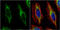Keratin 14 antibody, GTX104124, GeneTex, Immunocytochemistry image 