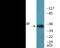 Cell Division Cycle 37 antibody, EKC2294, Boster Biological Technology, Western Blot image 