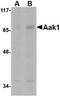 AP2 Associated Kinase 1 antibody, NBP1-76343, Novus Biologicals, Western Blot image 