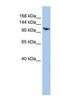 Ring Finger Protein 20 antibody, NBP1-52985, Novus Biologicals, Western Blot image 