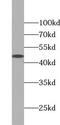 Tribbles Pseudokinase 2 antibody, FNab08965, FineTest, Western Blot image 