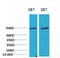Phosphoinositide-3-Kinase Regulatory Subunit 1 antibody, GTX34122, GeneTex, Western Blot image 