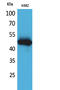 Interleukin-5 receptor subunit alpha antibody, STJ96579, St John