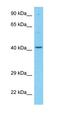 Absent In Melanoma 2 antibody, orb330614, Biorbyt, Western Blot image 