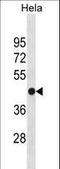 Fumarate Hydratase antibody, LS-C159654, Lifespan Biosciences, Western Blot image 