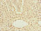 Deoxythymidylate Kinase antibody, LS-C675667, Lifespan Biosciences, Immunohistochemistry paraffin image 