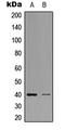 Zinc Finger Protein 134 antibody, LS-C354556, Lifespan Biosciences, Western Blot image 