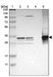 Thiosulfate Sulfurtransferase antibody, NBP1-87147, Novus Biologicals, Western Blot image 
