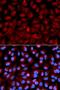 Histone Deacetylase 6 antibody, LS-C331664, Lifespan Biosciences, Immunofluorescence image 