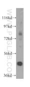 Acyl-CoA Dehydrogenase Long Chain antibody, 17526-1-AP, Proteintech Group, Western Blot image 