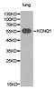 Potassium Voltage-Gated Channel Subfamily Q Member 1 antibody, LS-C193091, Lifespan Biosciences, Western Blot image 