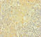 AKT Serine/Threonine Kinase 2 antibody, LS-C370815, Lifespan Biosciences, Immunohistochemistry paraffin image 