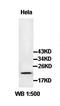 Interleukin 17B antibody, orb77827, Biorbyt, Western Blot image 