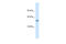 Potassium Voltage-Gated Channel Subfamily A Member Regulatory Beta Subunit 1 antibody, 28-245, ProSci, Enzyme Linked Immunosorbent Assay image 