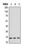 Cofilin 1 antibody, orb393241, Biorbyt, Western Blot image 