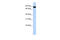 Activating Transcription Factor 6 Beta antibody, 25-018, ProSci, Enzyme Linked Immunosorbent Assay image 