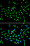 Cyclin Dependent Kinase Inhibitor 3 antibody, 18-472, ProSci, Immunofluorescence image 