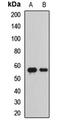 Beta-Secretase 1 antibody, LS-C668444, Lifespan Biosciences, Western Blot image 