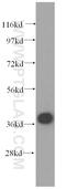 Proteasome 26S Subunit, ATPase 6 antibody, 15839-1-AP, Proteintech Group, Western Blot image 